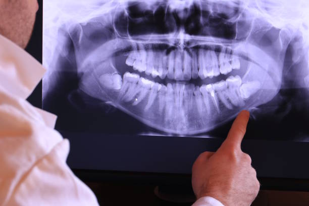 Best Emergency Dentist for Lost Fillings or Crowns in Smithville, NJ
