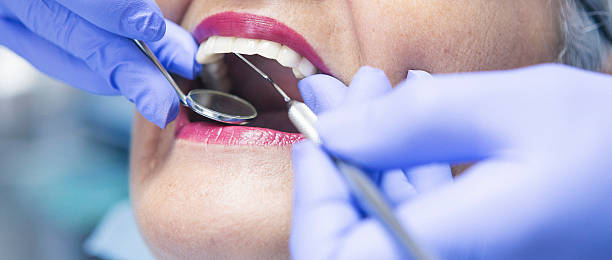 Best Broken or Cracked Tooth Emergency Dentist in Smithville, NJ